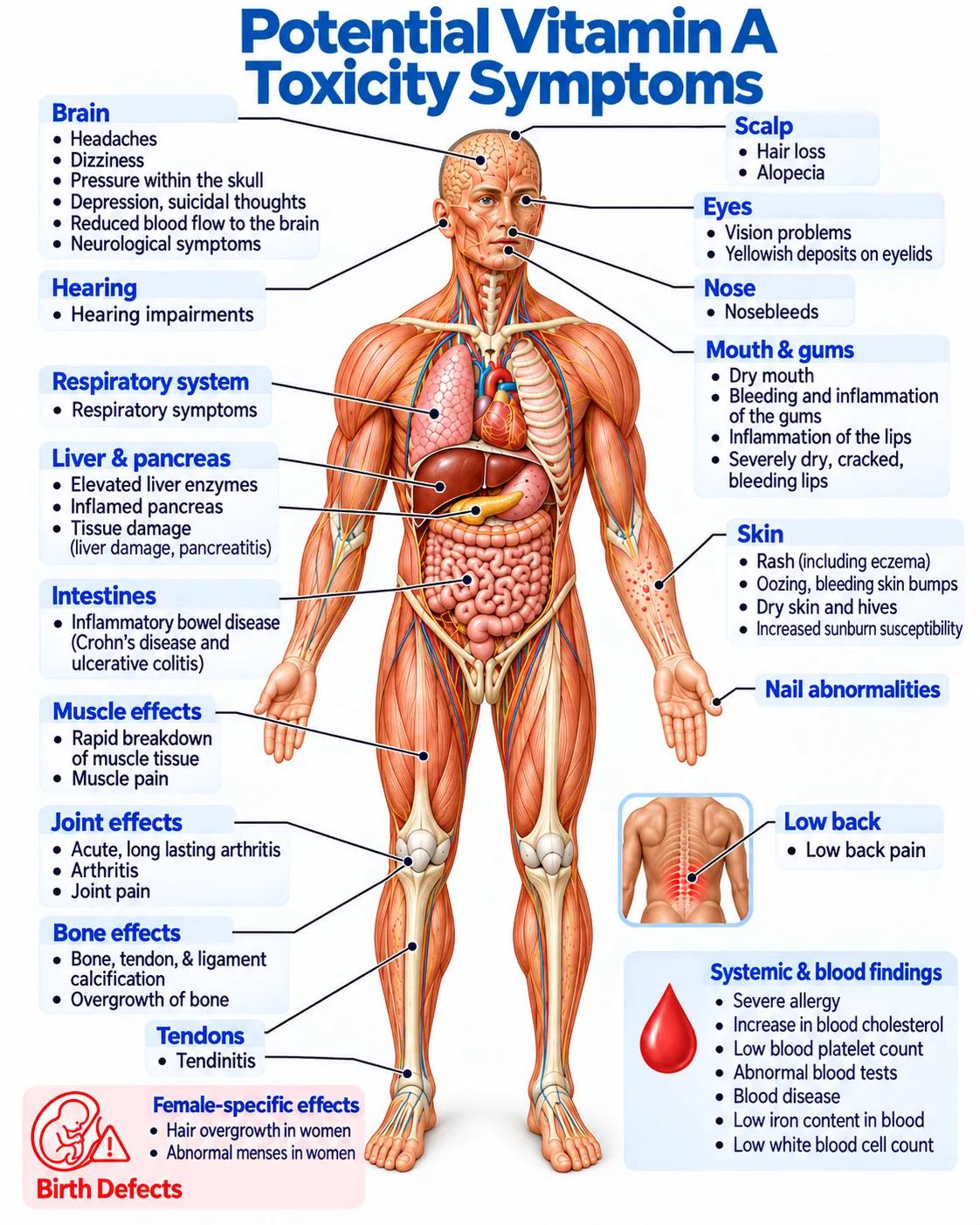 Symptoms of vitamin A toxicity