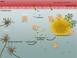 Amyloid Plaque