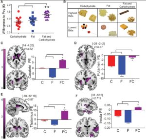 Brain Monitoring Carbs Fats